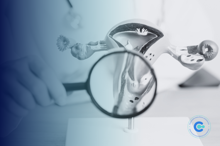 câncer do colo do útero